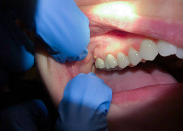 Professional Emergency Dental Service in NM