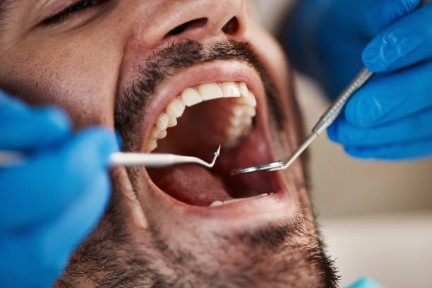 Best Broken or Chipped Tooth Repair in Carlsbad, NM